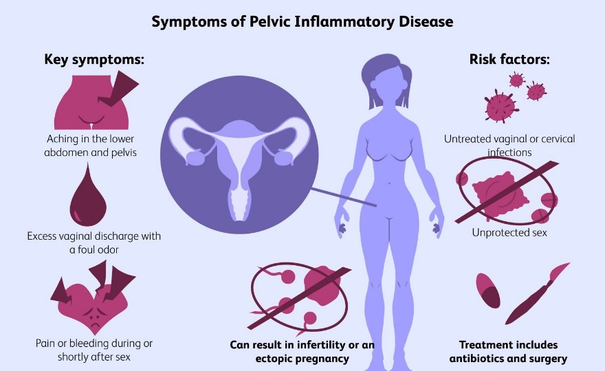 Inflammatory diseases of female organs: vaginitis, endometritis, salpingitis: